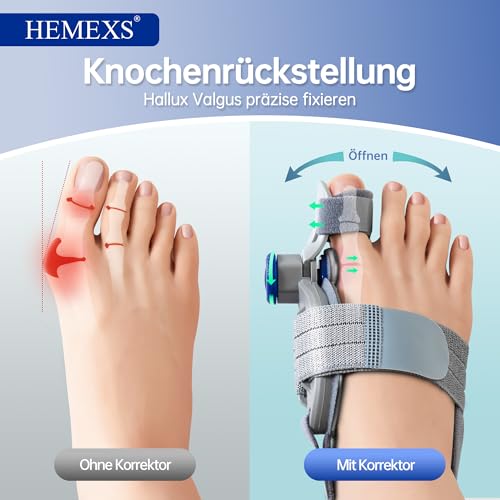 Hallux Valgus Korrektur Zehenspreizer Hallux Valgus – Schiene & Bandage, Verstellbarer Großzehenklemmer zur Schmerzlinderung & Ausrichtung, Für Damen & Herren, Links & Rechts (Tag- & Nachtgebrauch)