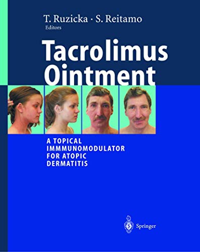 Preisvergleich Produktbild Tacrolimus Ointment: A Topical Immunomodulator for Atopic Dermatitis