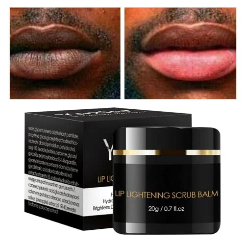 Top 10 Best Lip Bleaching Cream Onsite Oil Field