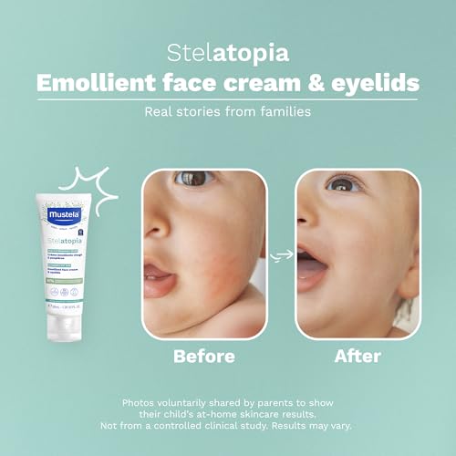 Mustela Stelatopia - Emollient Baby Face Cream - For Eczema-Prone Skin - with Natural Avocado & Ceramides - Fragrance Free - 1.35 fl. oz.
