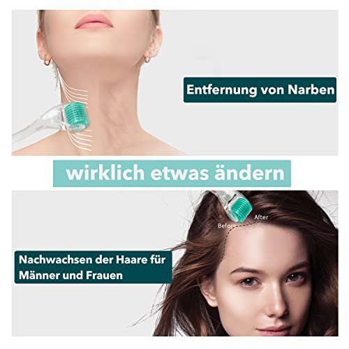 AUDUODUO® Derma roller 192 echte nadeln 0.5mm mit REAL SILVER Nadeln Microneedle roller for Face - Image 6