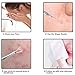Professional Facial Milia Removal and Whitehead Extractor & Lancet - Double Ended Circle Loop & Sharp Needle Pimple Popper Tool - 2-in-1 Blackhead & Blemish Remover - Zit and Pimple Acne Removal
