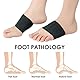 Fußbandage Mittelfuß für Mittelfußschmerzen-2 Paar Atmungsaktive Fußsocken zur Schmerzlinderung bei Plattfüßen,Entlasten Sie Stress, Fußpflege für Frauen und Männer,Größe L, Farben Schwarz und Beige