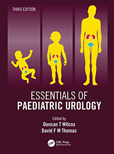 Essentials of Pediatric Urology - //medicalbooks.filipinodoctors.org