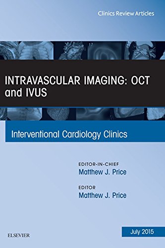 Intravascular Imaging: OCT and IVUS, An Issue of Interventional Cardiology Clinics (The Clinics: Internal Medicine Book 3) (English Edition)