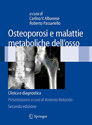 Osteoporosi e malattie metaboliche dell'osso. Clinica e diagnost