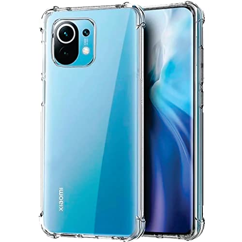 Kit Capa Capinha Case Para Xiaomi Mi 11 Lite + Película De Cerâmica 9D + Película De Câmera (GL BRAZ