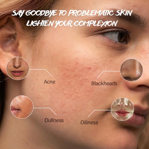 Turmeric Exfoliating Face Wash Vitamin C Facial Cleanser Microdermabrasion Exfoliator Face Scrub Foaming Cleanser Removing Blackhead Acne Moisturizing Soft Natural Skin Care for Women Men - Image 5