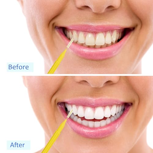 Image of Patelai 100 Pieces Braces Dental Brush for Cleaner Interdental Toothpick Dental Tooth Flossing Head Oral Hygiene Flosser Toothpick Cleaners Tooth Tool(Blue, Yellow,Multiple Sizes)