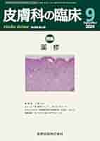 薬疹の診断と治療アップデ-ト 重症薬疹を中心に/医薬ジャ-ナル社/塩原哲夫（単行本） 薬疹の診断と治療アップデ-ト 重症薬疹を中心に/医薬ジャ-