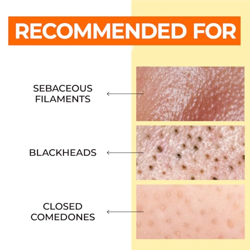 numbuzin Nr.1 Reinigungsöl | Easy Peasy Reinigungsöl | Gesichtsreiniger, Make-up-Entferner, porentiefereiningung, entfernt Mitesser, nicht beschwerend | koreanische Hautpflege | 200 ml