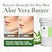 SAAQIN Aloe Vera Butter –Hydration of Dry Skin Caused By Eczema, Psoriasis, Rosacea, Sun Burn, Wind Burn, and General Chapping 16 Oz