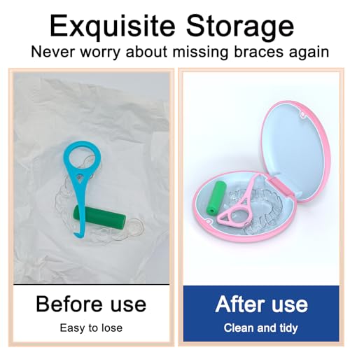 ARGOMAX Aligner Case, Retainer Case, Braces Box, 1 Piece Orthodontic Box (Pink + Light Blue Silicone).