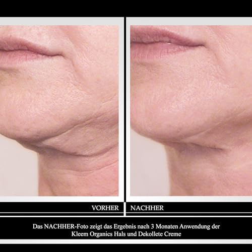 Hals und Dekollete Creme mit Peptiden und Retinol - Neck Firming Cream zur Reduzierung von Falten, Halslinien und Schlaffer Haut - Natürliche Firming Neck Cream für Glatte und Jugendliche Haut - 50 ml