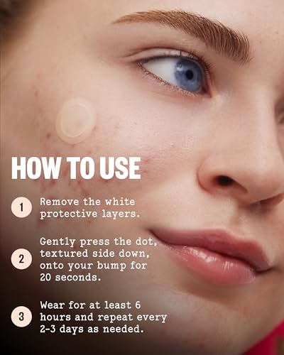 PEACE OUT Early Stage Acne Dots — view 7