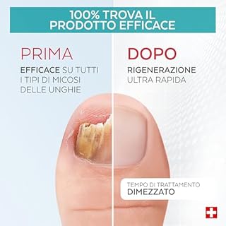 PODERM MICOSI UNGHIA PIEDE COMPLEMENT BOOSTER -Trattamento micosi unghie piedi – Dimezza durata trattamento – Non utilizzare solo – Prodotto in Svizzera