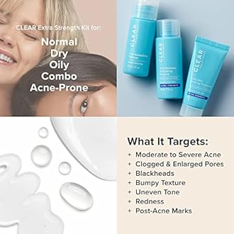 Paula's Choice CLEAR 3-Piece Acne Kit, Includes Daily Cleanser, 2% Salicylic Acid Exfoliant & Benzoyl Peroxide Treatment, Prevents & Treats Mild to Severe Acne & Breakouts, Fragrance-Free, Set of 3