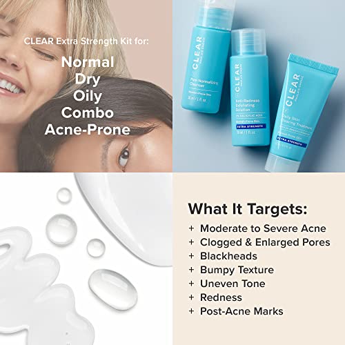 Paula's Choice CLEAR 3-Piece Acne Kit, Includes Daily Cleanser, 2% Salicylic Acid Exfoliant & Benzoyl Peroxide Treatment, Prevents & Treats Mild to Severe Acne & Breakouts, Fragrance-Free, Set of 3