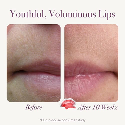 reVive Light Therapy Revive Lux Collection Dispositivo De Aumento Labial Para Terapia De Luz Vermelh
