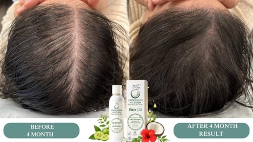 Image of Ashwamegh Ayurvedic Hair Oil for Hair Fall Control & Hair Growth | Bhringraj, Ashwagandha & amlaa 9 Herbs | Natural Hair Oil for Men & Women | Anti Hairfall | 100ml