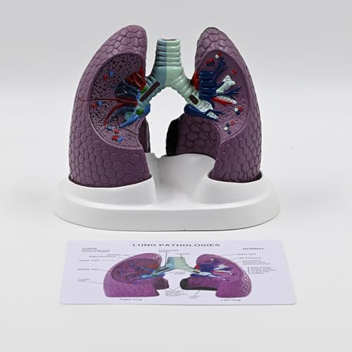 Modèle anatomique pulmonaire humain normal et pathologique pour cours médicaux - 6