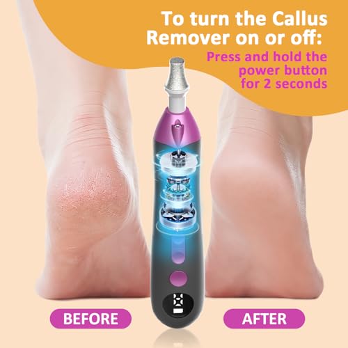 Image of Mfish Electric Callus Remover for Feet, Rechargeable Foot File with Digital Display, 9 Speeds & 8 Grinding Heads, Professional Pedicure Tool for Thick Calluses, Cracked Heels & Hard Skin Black