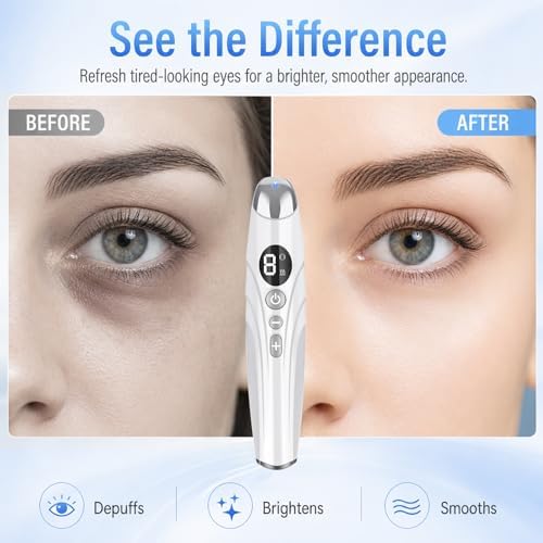 Heated Eye Wand with Serum Infusion Port |Warming Facial Wand for Better Absorption with Blue Red Purple Light, Portable Eye Applicator for Daily Skincare Routine — view 2