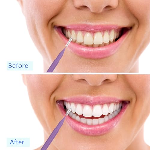 Image of Patelai 100 Pieces Braces Dental Brush for Cleaner Interdental Toothpick Dental Tooth Flossing Head Oral Hygiene Flosser Toothpick Cleaners Tooth Tool(Pastel Colors,Mixed Size)