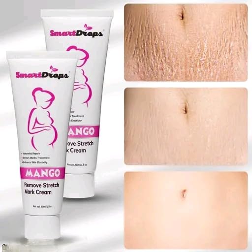 Skin elastic enhancing Stretch marks removal maternity repair cream (1)-image-24