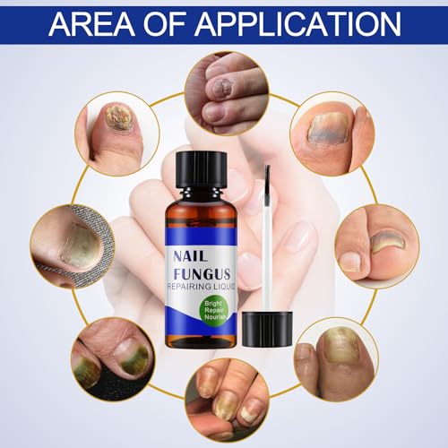 Apooliy 30ML Toenail Fungus Treatment Extra Strength - Image 3