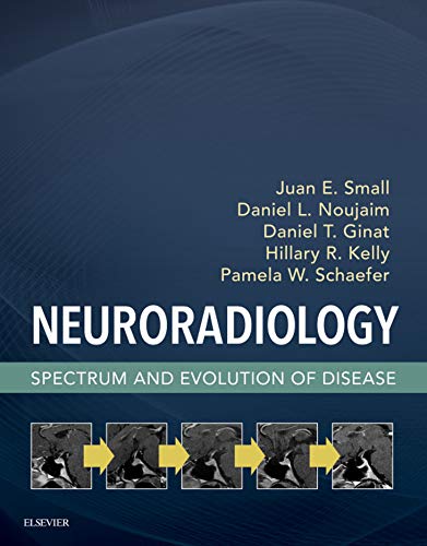 Neuroradiology: Spectrum and Evolution of Disease Neuroradiology: Spectrum and Evolution of Disease