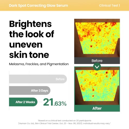 Image of AXIS-Y Dark Spot Correcting Glow Serum - 5% Niacinamide Dark Spot Remover For Face - Vegan Korean Skin Care Niacinamide Serum for All Skin Types (1.69 fl. oz.)