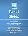 Boards and Beyond Renal Slides (Boards and Beyond Black and White Slides)
