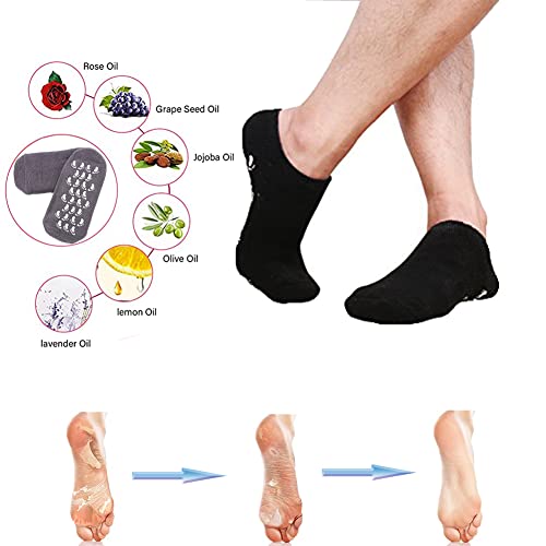2 Pairs Short Moisturizing Socks, Waltok Cotton Spa Gel Moisture Socks Gel Inner Lining Infused With Essential Oils, Best For Repairing Softening Dry Cracked Feet Skins Overnight #TOP3