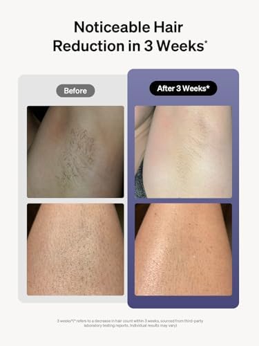 Ulike Laser Hair Removal for Women and Men, Air 3 IPL Hair Removal with Sapphire Ice-Cooling System for Nearly Painless & Long-Lasting Result, for Body & Face at-Home Use