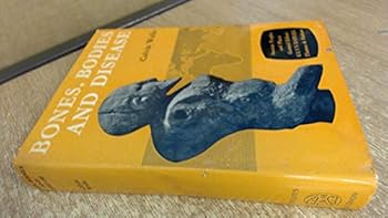 Hardcover Bones, Bodies and Disease : Evidence of Disease and Abnormality in Early Man Book