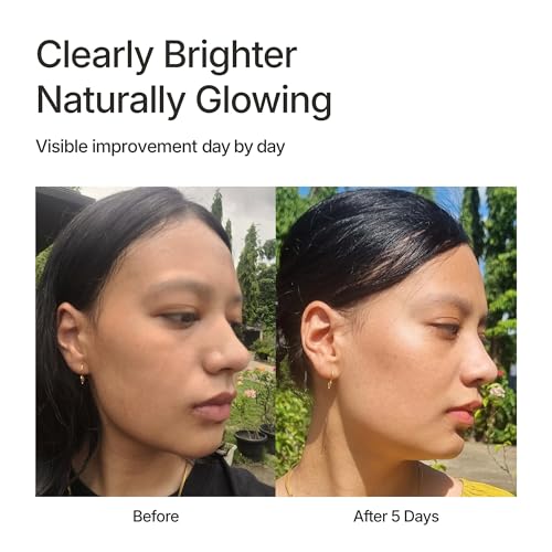 Image of yeoul Goheung Yuja C Vita Brightening Serum 30mL | Korean Face Serum for Pigmentation, Dark Spots & Uneven Tone | Yuja Vitamin C + 5% Niacinamide | Antioxidant Glow & Hydrating Barrier Care