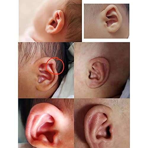 Patch per la Correzione del Padiglione Auricolare