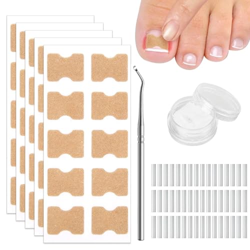 Juego de 50 parches de corrección de uñas encarnadas con 50 tiras de alisado de uñas de los pies sin dolor y elevador de uñas, juego para corregir las uñas encarnadas