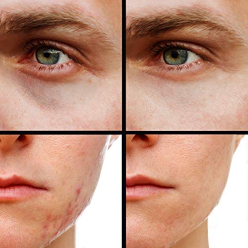 Kode Mens Concealer (Shade 3 Of 6) Dark Circle Under Eye Cream Corrector, Multi-Use, Pimples, Scars, Rashes #TOP5