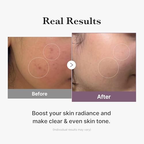 Image of Medicube Age-R Glutathione Glow Milky Toner, Double Layer Korean Skincare, Peptide Formula for Radiant Skin