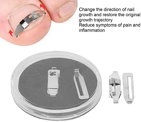 Ingrown Toenail Corrector, 2 Pcs Paronychia Correction Tool Stainless Steel Ingrown Toenail Corrector Pedicure Tool for Toenail Correction