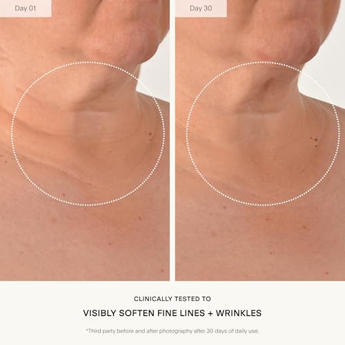 Alt Text for image 3: Visible results of firmed and hydrated skin