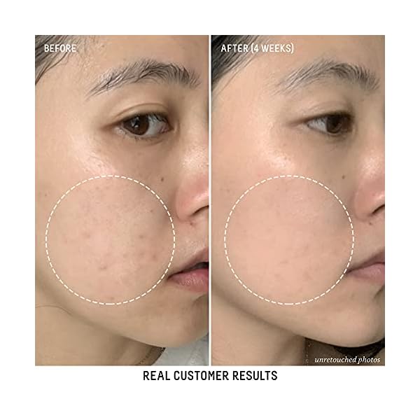 Biossance Squalane + Vitamin C Dark Spot Serum. Powerful Lightweight Serum with 10% to Brighten Skin Fade Spots Reduce and ounces