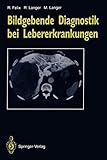 scanner heidelberg topaz  Bildgebende Diagnostik bei Lebererkrankungen