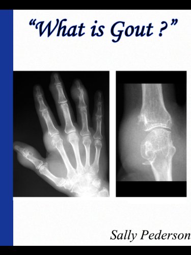 What is Gout? The Ultimate Guide To Mastering and Conquering Gout. Know the Symptoms of Gout, Causes of Gout, Treatment for Gout and more.