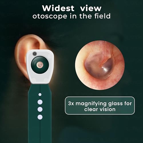 Image of OTICA 3.7V Professional Diagnostic Pocket LED Otoscope | Rechargeable In-Built 3500mAh Battery | Type-C Charging | Adjustable Intensity | 10 Disposable Specula + Spare Glass | 11707 - Green