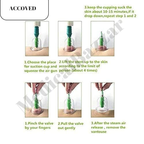 Image of Medical Bazaar Cupping Therapy Cups | Hijama Cupping Set (Size 0-6) | Loose Cups for Professional Cupping Therapy|Pain Relief |Massage| Detox Therapy (S0-7CM(Set of 10Pcs))
