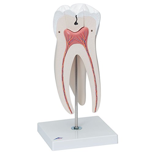 Image of 3B Scientific D15 Giant Molar w / Dental Caries 15x life-size 6-part - 3B Smart Anatomy