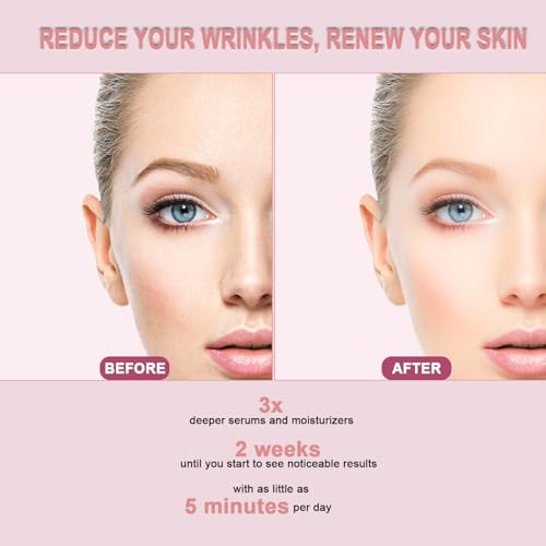 Red Light Therapy for Face, 6 in 1 LED Light Therapy Eye Equipment for Skin,Face Wand with Facial Massager, Skincare Facial Wand,Vibration, Thermal, Microcurrent，Portable Beauty Tools — view 6